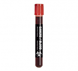 15 ml blood tube