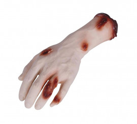 Hand with 25 cm wounds