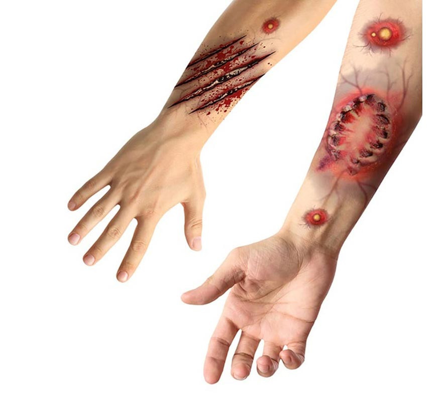Adhesive Tattoos of Bite Wounds Adhesive Tattoos of Bite Wounds